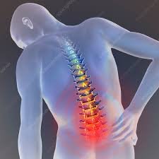 Low Back Pain Management