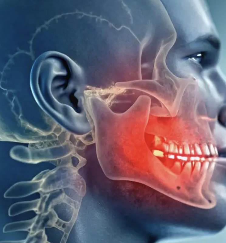 TMJ Relief and Jaw Mobility